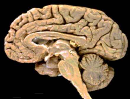 20071120110752-cerebro9.jpg
